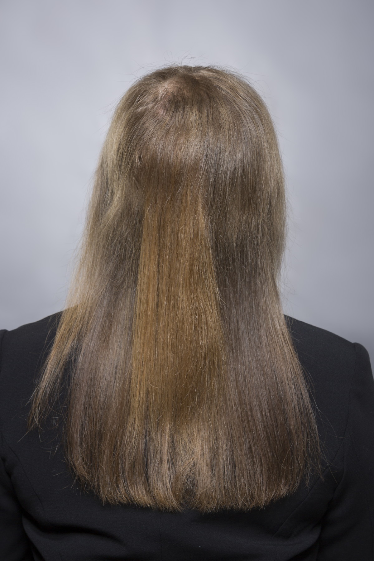 Kopfhaut dünne sichtbar haare Hochsteckfrisuren für